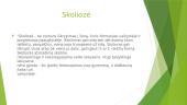 Skoliozės prevencija