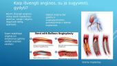 Krūtinės angina 2 puslapis
