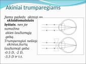Akies optinės savybės. Skaidrės 14 puslapis