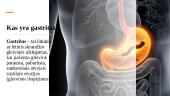 Gastritas. Opaligė. Jų etiologija, klinikiniai požymiai  3 puslapis