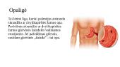 Gastritas. Opaligė. Jų etiologija, klinikiniai požymiai  7 puslapis