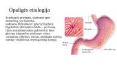 Gastritas. Opaligė. Jų etiologija, klinikiniai požymiai  8 puslapis