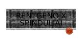Rentgeno x spinduliai