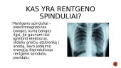 Rentgeno x spinduliai 2 puslapis