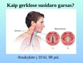 Kvėpavimo sistemos organai 9 puslapis