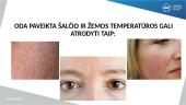 Temperatūros poveikis odai, plaukams ir nagams. Odos histologija 4 puslapis