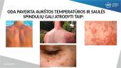 Temperatūros poveikis odai, plaukams ir nagams. Odos histologija 8 puslapis