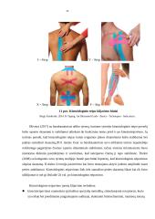 Kineziteipavimo poveikis vaikų kelio sąnario funkcijai, stabilumui, pusiausvyrai 18 puslapis