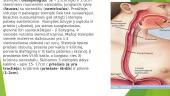 Stemplė, skrandis 2 puslapis