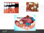 Vaikų odontologijos principai. Ortodontinis gydymas. Dantų vystymasis bei dygimas 13 puslapis