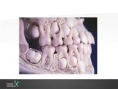 Vaikų odontologijos principai. Ortodontinis gydymas. Dantų vystymasis bei dygimas 6 puslapis