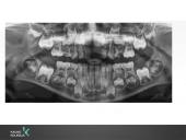 Vaikų odontologijos principai. Ortodontinis gydymas. Dantų vystymasis bei dygimas 7 puslapis