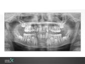 Vaikų odontologijos principai. Ortodontinis gydymas. Dantų vystymasis bei dygimas 8 puslapis
