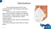 Oro lašeliniu būdu plintanti liga. Tuberkuliozė 2 puslapis