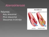 Širdies ir kraujagyslių ligos. Skaidrės 2 puslapis