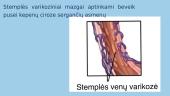 Stemplės venų mazgai 2 puslapis