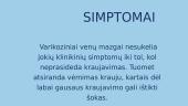 Stemplės venų mazgai 4 puslapis