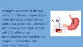 Stemplės venų mazgai 6 puslapis
