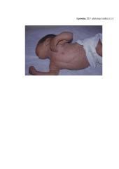 Naujagimių, kuriems nustatytas imunodeficito virusas slauga 17 puslapis