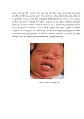 Naujagimių, kuriems nustatytas imunodeficito virusas slauga 9 puslapis