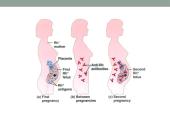 Rh izoimunizacija 4 puslapis