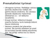 Dauno sindromas (skaidrės pristatymui) 4 puslapis