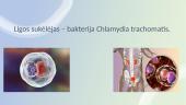 Chlamidiozė 2 puslapis