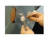 Bendrieji klinikiniai laboratoriniai tyrmai (likvoras) 5 puslapis