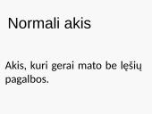 Akies optinės savybės (pristatymas) 9 puslapis