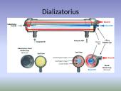 Hemodializės procedūra 11 puslapis