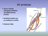 Hemodializės procedūra 8 puslapis