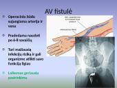 Hemodializės procedūra 9 puslapis