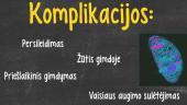 Toksoplasmozė 3 puslapis