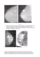 Mamografija 13 puslapis