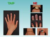 Ligoninių higiena, hospitalinės infekcijos 20 puslapis