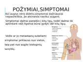 Vėžinės ląstelės (skaidrės) 11 puslapis