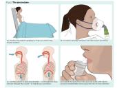 Skreplių tyrimas 7 puslapis