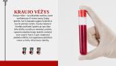 Kraujo ligos (skaidrės) 6 puslapis