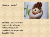 Prigimtinė teisė į gyvybę. Abortas 2 puslapis