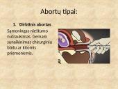 Prigimtinė teisė į gyvybę. Abortas 3 puslapis