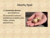 Prigimtinė teisė į gyvybę. Abortas 4 puslapis