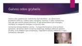 Galvos odos ligos 7 puslapis