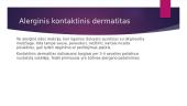 Galvos odos ligos 8 puslapis