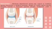 Kelio sąnario artritas 3 puslapis
