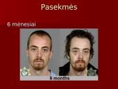 Narkotikai ir jų žala. Skaidrės 15 puslapis