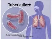 Tuberkuliozė (skaidrės)
