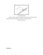 Pjezoelektriniai filtrai 5 puslapis