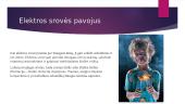 Elektros srovės poveikis žmogaus organizmui (pristatymas) 2 puslapis