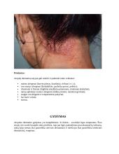 Atopinis dermatitas (referatas) 5 puslapis