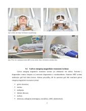 Galvos smegenų magnetinio rezonanso tomografijos tyrimas 6 puslapis